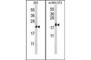 Western blot analysis of RPL18A Antibody (C-term) Cat. (RPL18A 抗体  (C-Term))