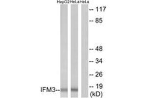 Western blot analysis of extracts from HepG2/HeLa cells, using IFM3 Antibody. (IFITM3 抗体  (AA 1-50))