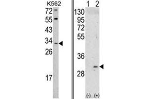 (LEFT) Western blot analysis of ITM2A Antibody (N-term) in K562 cell line lysates (35ug/lane). (ITM2A 抗体  (N-Term))