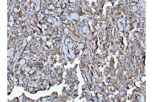 IHC analysis of CD147/Emmprin using anti-CD147/Emmprin antibody (ABIN7599999).