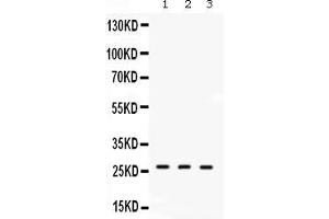 Western blot analysis of DDAH2 expression in rat lung extract ( Lane 1), mouse lung extract ( Lane 2) and human placenta extract ( Lane 3). (DDAH2 抗体  (C-Term))