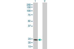 Western Blot analysis of RERGL expression in transfected 293T cell line by RERGL MaxPab polyclonal antibody. (RERGL 抗体  (AA 1-205))