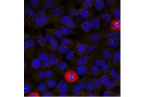 Image no. 1 for anti-Eukaryotic Translation Initiation Factor 4 Gamma, 1 (EIF4G1) (Ser1232) antibody (ABIN319387) (EIF4G1 抗体  (Ser1232))