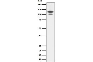 Western blot analysis of RASA1 expression in Rat brain cell lysate.
