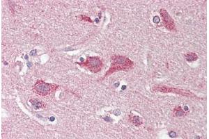 anti-Opioid Binding Protein/cell Adhesion Molecule-Like (OPCML) antibody