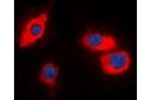 Immunofluorescent analysis of CIDEB staining in HT29 cells. (CIDEB 抗体)