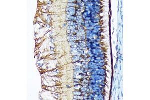 Immunohistochemistry of paraffin-embedded mouse retina using CRALBP Rabbit mAb (ABIN7269934) at dilution of 1:100 (40x lens). (RLBP1 抗体)