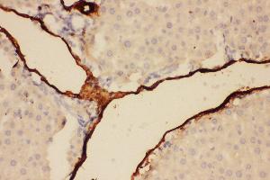Immunohistochemistry (IHC) image for anti-Adiponectin (ADIPOQ) (AA 19-244) antibody (ABIN3042521)