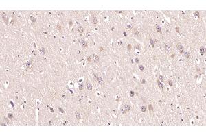 Detection of MOG in Human Cerebrum Tissue using Monoclonal Antibody to Myelin Oligodendrocyte Glycoprotein (MOG) (MOG 抗体  (AA 30-149))