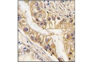 Immunohistochemistry (IHC) image for anti-EPH Receptor B2 (EPHB2) antibody (ABIN356401)