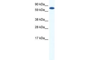 Western Blotting (WB) image for anti-Core-binding Factor, Runt Domain, alpha Subunit 2, Translocated To, 2 (CBFA2T2) antibody (ABIN2461546)