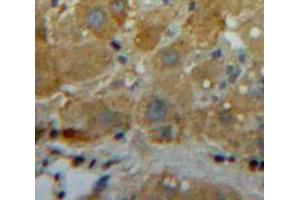 Used in DAB staining on fromalin fixed paraffin-embedded Liver tissue (COL18 抗体  (AA 1572-1754))