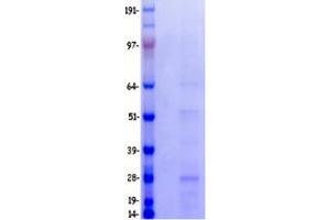 Validation with Western Blot (CD3 Protein (CD3) (Myc-DYKDDDDK Tag))