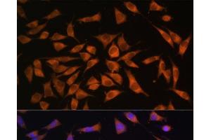 Immunofluorescence analysis of L929 cells using PMM2 Polyclonal Antibody at dilution of 1:100. (PMM2 抗体)