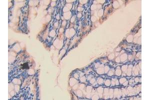 Immunohistochemistry (IHC) image for anti-ATPase, Na+/K+ Transporting, beta 1 Polypeptide (ATP1B1) (AA 53-304) antibody (ABIN1858096)