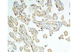 IHC analysis of Caspase-3 using anti-Caspase-3 antibody (ABIN6719555).