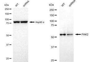 Western blotting analysis using PAK2 antibody (ABIN7799719). (Recombinant PAK2 抗体)