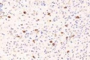 Immunohistochemistry analysis of paraffin-embedded mouse brain using RASGRP3 (ABIN7075376) at dilution of 1: 1000