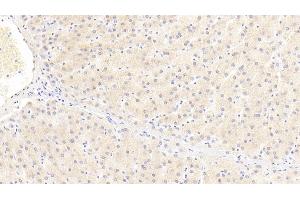 Detection of ITIH4 in Human Liver Tissue using Polyclonal Antibody to Inter Alpha-Globulin Inhibitor H4 (ITIH4) (ITIH4 抗体  (AA 29-157))