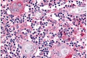 Human Thymus (formalin-fixed, paraffin-embedded) stained with USP4 antibody ABIN213585 at 5 ug/ml followed by biotinylated goat anti-rabbit IgG secondary antibody ABIN481713, alkaline phosphatase-streptavidin and chromogen. (USP4 抗体  (Internal Region))