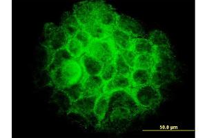 Immunofluorescence of monoclonal antibody to TRIB3 on A-431 cell. (TRIB3 抗体  (AA 56-145))