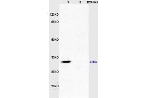 Lane 1: mouse brain lysates Lane 2: mouse kidney lysates probed with Anti SDHB Polyclonal Antibody, Unconjugated (ABIN719411) at 1:200 in 4 °C. (SDHB 抗体  (AA 201-280))