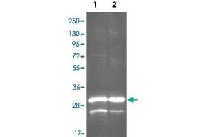 Western Blot analysis by gdh polyclonal antibody  at 1:3000. (Glutamate Dehydrogenase (GDH) 抗体)