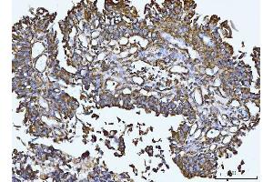 IHC analysis of Integrin linked ILK using anti-Integrin linked ILK antibody (ABIN7602632). (ILK 抗体  (AA 9-452))