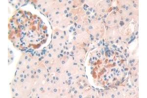 Immunohistochemistry (IHC) image for anti-serpin Peptidase Inhibitor, Clade A (Alpha-1 Antiproteinase, Antitrypsin), Member 10 (SERPINA10) (AA 278-425) antibody (ABIN7438085)