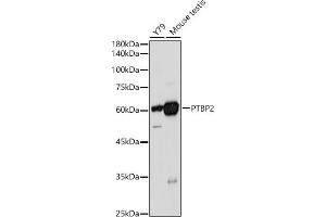 Western blot analysis of extracts of various cell lines, using PTBP2 antibody (ABIN6128372, ABIN6146373, ABIN6146374 and ABIN6221684) at 1:1000 dilution. (PTBP2 抗体  (AA 1-280))
