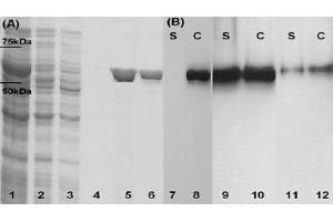 SDS–PAGE and Western blots that confirm LLO production by three of the constructed strains. (LLO 抗体)