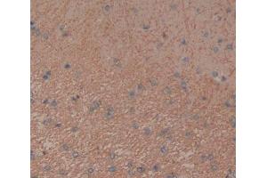Used in DAB staining on fromalin fixed paraffin- embedded brain tissue (Tenascin R 抗体  (AA 329-588))