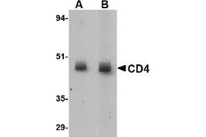 Western Blotting (WB) image for anti-CD4 (CD4) (N-Term) antibody (ABIN492544) (CD4 抗体  (N-Term))