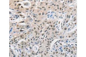 Immunohistochemistry (IHC) image for anti-Cell Division Cycle 27 Homolog (S. Cerevisiae) (CDC27) antibody (ABIN2427931) (CDC27 抗体)