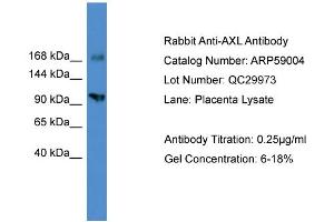 WB Suggested Anti-AXL  Antibody Titration: 0. (AXL 抗体  (C-Term))