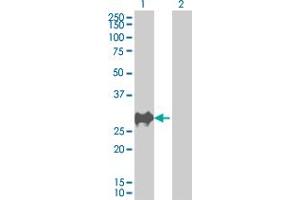 Western Blot analysis of CDKN1B expression in transfected 293T cell line by CDKN1B MaxPab polyclonal antibody. (CDKN1B 抗体  (AA 1-198))