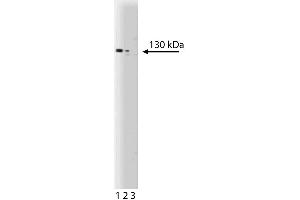 Western blot analysis of Apaf-1 on a human endothelial cell lysate. (APAF1 抗体  (AA 252-445))