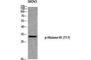 Western Blot (WB) analysis of SKOV3 using p-Histone H1 (T17) antibody. (Histone H1 抗体  (pThr17))