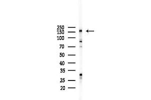 anti-Mediator Complex Subunit 1 (MED1) (C-Term) antibody