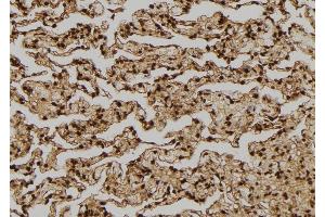 ABIN6276314 at 1/100 staining Human lung tissue by IHC-P.