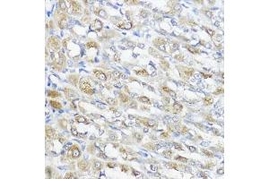 Immunohistochemistry of paraffin-embedded rat stomach using GPX2 antibody (ABIN7267435) at dilution of 1:100 (40x lens). (Glutathione Peroxidase 2 抗体  (AA 100-180))
