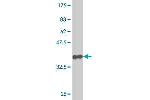 Western Blot detection against Immunogen (36. (Nucleostemin 抗体  (AA 328-427))