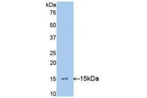 Western blot analysis of recombinant Mouse IL15. (IL-15 抗体  (AA 49-162))