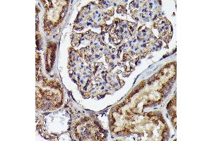 Immunohistochemistry of paraffin-embedded human kidney using Human IgM Rabbit mAb (ABIN7267845) at dilution of 1:100 (40x lens). (IGHM 抗体)