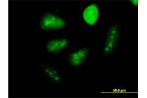 Immunofluorescence of monoclonal antibody to GCM1 on HeLa cell. (GCM1 抗体  (AA 108-166))