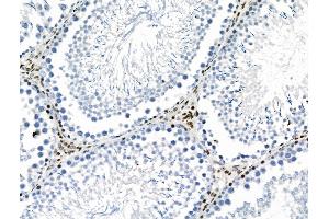 Phospho-YAP (Ser941) Antibody at 1/100 staining Rat testis tissue by IHC-P. (YAP1 抗体  (pSer941))