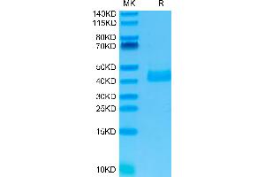 Human NKp46 on Tris-Bis PAGE under reduced condition. (NCR1 Protein (AA 22-254) (His tag))
