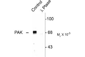 Western blots of rat hippocampal lysate showing specific immunolabeling of the ~68k to ~70k PAK protein (Control). (PAK1-3 (pThr402) 抗体)