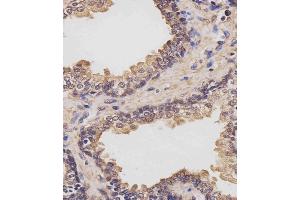 (ABIN6243855 and ABIN6577442) staining RK7 in human prostate tissue sections by Immunohistochemistry (IHC-P - raformaldehyde-fixed, raffin-embedded sections). (PARK7/DJ1 抗体  (C-Term))