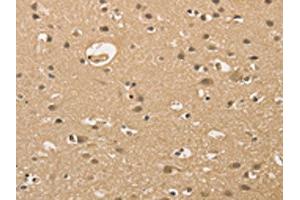 The image on the left is immunohistochemistry of paraffin-embedded Human brain tissue using ABIN7128351(ALDH8A1 Antibody) at dilution 1/30, on the right is treated with fusion protein. (ALDH8A1 抗体)